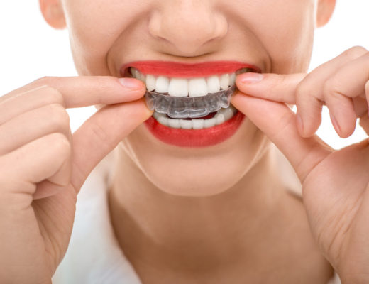 Wer mit einem schönen Lächeln punkten möchte, kann sich seine Zähne mit modernen Methoden quasi unsichtbar verschönern lassen.